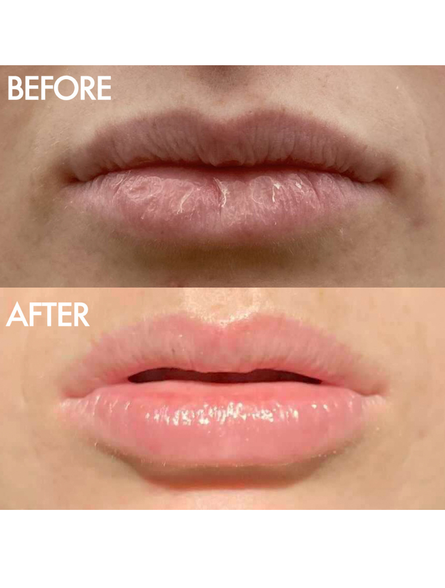 before & after