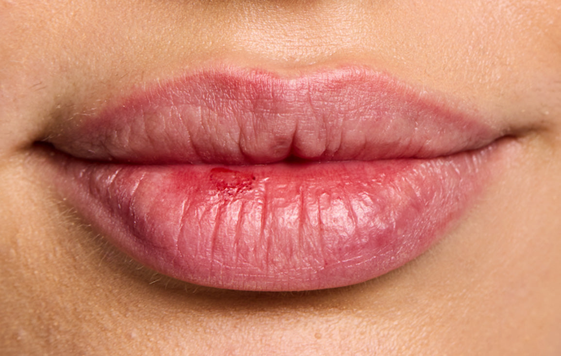 Close up of a model's lips before applying the Lanolips Hyaluronic Lip Oil in Raspberry. 
