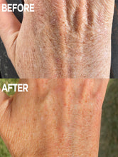 Load image into Gallery viewer, Before &amp; After of Hand using Golden Dry Skin Miracle Salve
