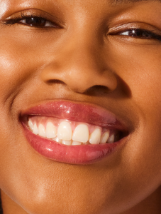 Close up shot of model wearing Lanolips Glossy Balm Candy.